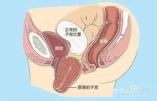 做完人流手术后需要休息多久才能站立上班？